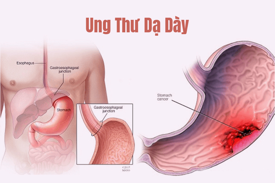 Các loại thuốc hoá trị sinh học phổ biến hiện nay là gì? 
