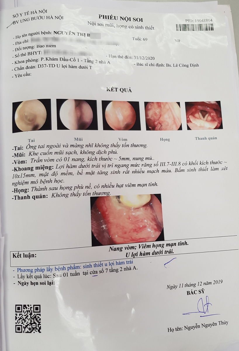 PHẪU THUẬT UNG THƯ LỢI HÀM SỬ DỤNG NẸP VÍT SINH HỌC ĐẢM BẢO TÍNH ...