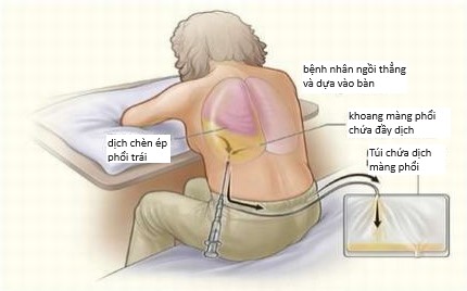 3. Quy Trình Thực Hiện